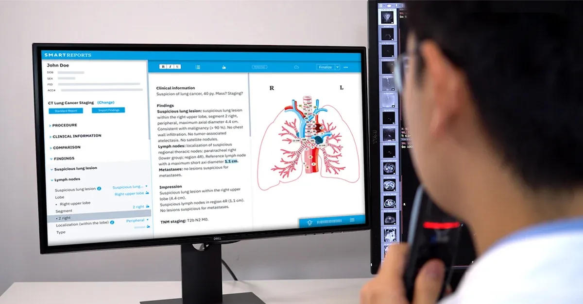 Smart Reporting raised 23 million EUR to expand its medical reporting product