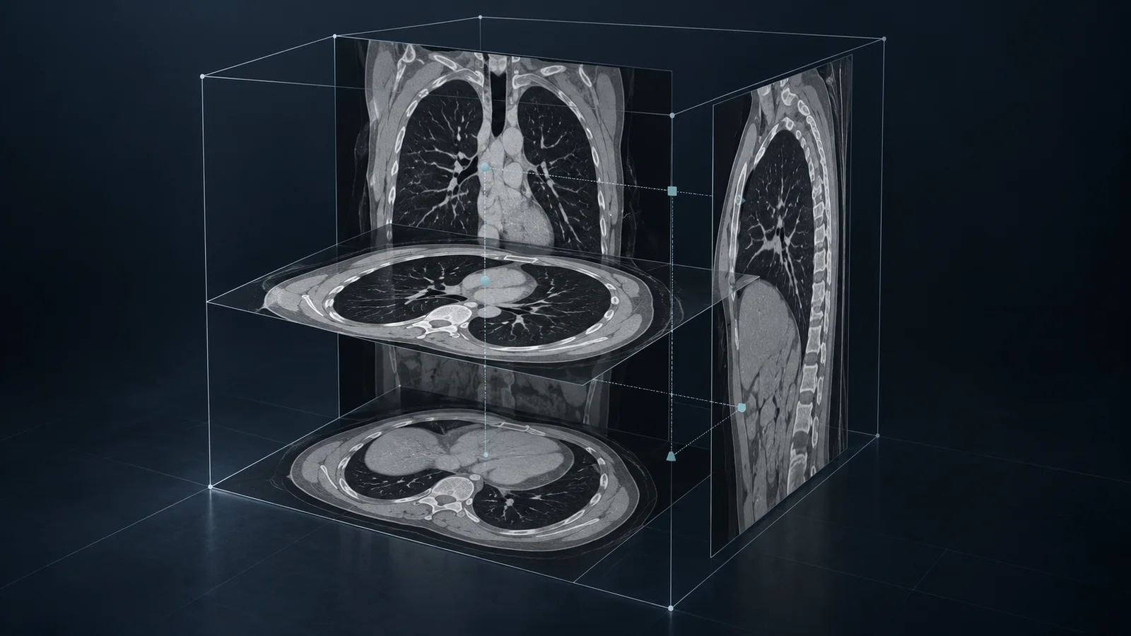 Conceptual chest CT volume with axial, coronal and sagittal slice planes connected by subtle spatial guide lines.